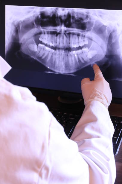 Best Emergency Wisdom Teeth Removal in Ridgely, MD